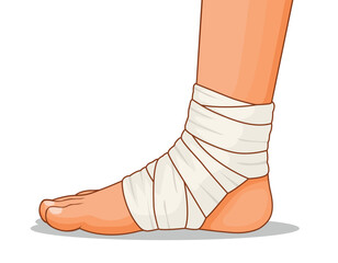 Injured leg with sprained ankles wrapped  in bandage