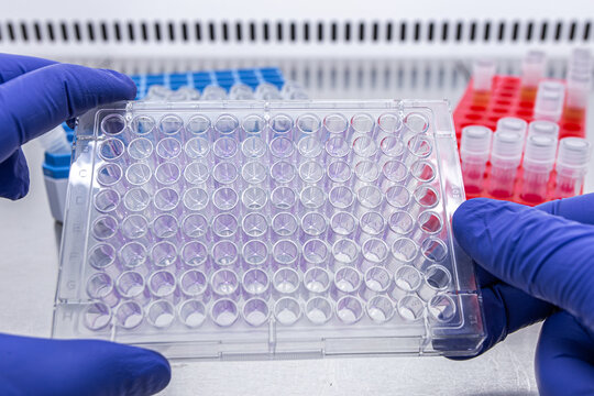 An immunological tablet in the hands of a doctor in a laboratory against the background of racks with test tubes.