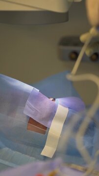 Lasik treatment. Laser vision correction. Doctor examines fundus in microscope, patient under sterile cover.