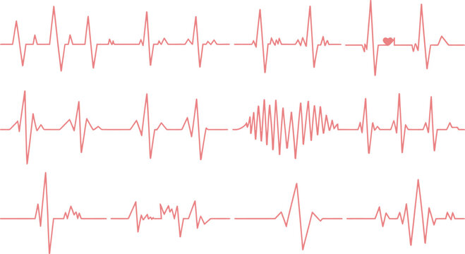 Ecg rhythm strip patterns and waveform analysis
