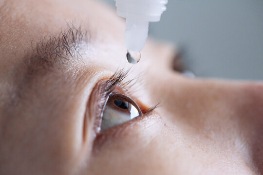 Close-up of eye drops being dropped into the eyes