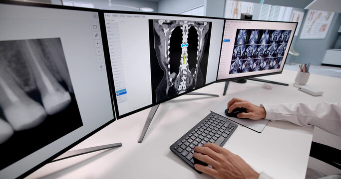 Male Surgeon Analyzing MRI Scan Results - Powered by Adobe