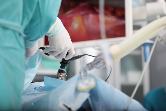 Laparoscopic instruments in the hands of a surgeon. Minimally invasive surgery. Operations on internal organs. Modern surgical method.