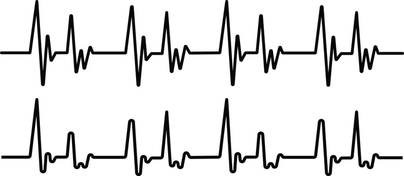 Electrocardiogram display showing heart rhythm patterns and cardiac activity readings