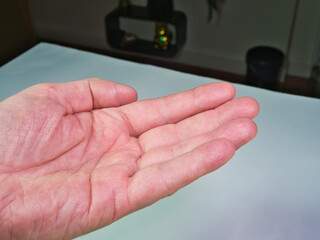 Open hand close-up showing dry skin texture; Close-up shot of an adult person's open palm, empty and facing up, highlighting dry, textured, and aging skin against a blurred background.