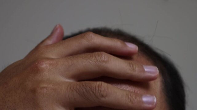 薄毛の頭を撫でる男性の頭（日本人、30代）