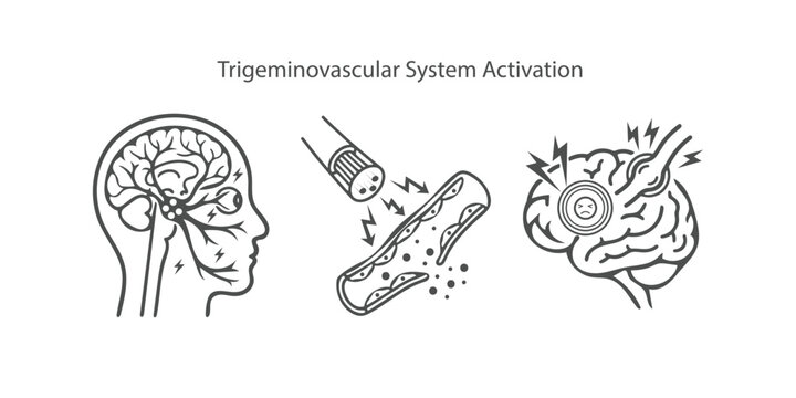 Trigeminovascular System Activation Icon Set. Vector Line Art of Migraine Mechanism, Trigeminal Nerve, and Brain Pain.