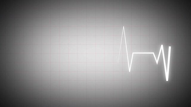 Clean white ECG heartbeat line animation on soft gray grid background, minimal medical pulse waveform design for healthcare visuals, diagnostics, technology displays, and modern UI elements in 4K.