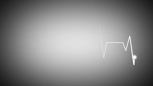 White cardiograph recording with heartbeat flatline and glowing endpoint on soft gray background, clean medical ECG waveform for healthcare, monitoring, and diagnostic visuals in high quality 4K.