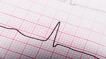 Health care background of Electrocardiogram plot