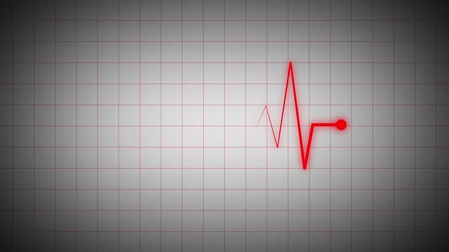 Red cardiogram waveform with glowing dot on gray grid background. Medical monitoring visual for healthcare technology, cardiology displays, clinical dashboards, and digital signal animation.