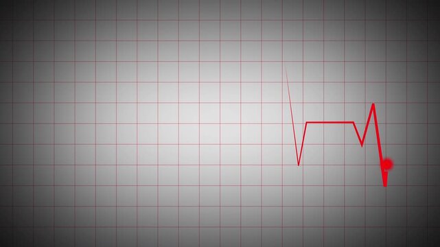 Cardiogram recording animation showing red ECG waveform with glowing endpoint on light grid background. Medical heartbeat monitor visual for healthcare technology, diagnostic interface, and digital cl