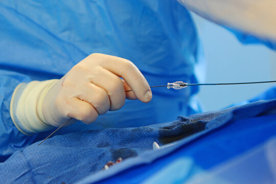 Operations to remove blood clots.Prevention of blood clots. Endovascular surgery. Surgical interventions on blood vessels.