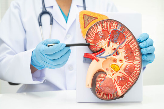 Chronic kidney disease, doctor with model for treatment urinary system, urology, Estimated glomerular filtration rate eGFR.