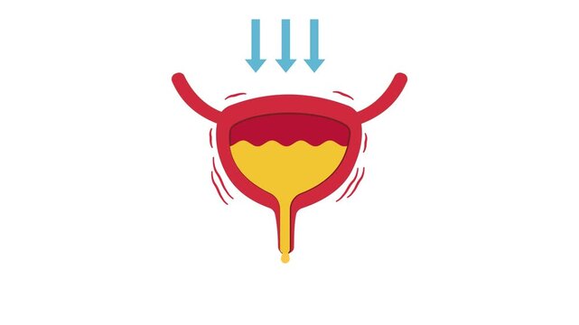 Urinary bladder pressure and urine leakage medical animation showing incontinence problem