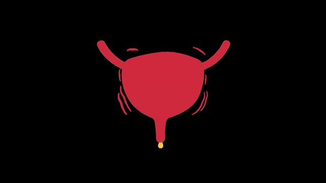 Painful urinary bladder spasm with urine drip medical animation illustrating bladder dysfunction alpha channel