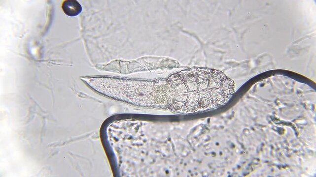 Demodex brevis mite moving and waving legs under 400x brightfield magnification. Internal organs and detailed body structure clearly visible in microscopic close-up view.