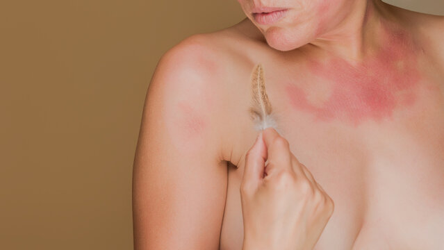 Woman experiencing skin allergy or irritation from feather
