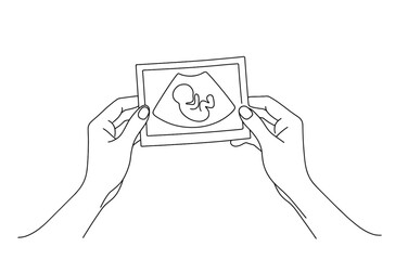 Linear drawing of hands holding ultrasound of baby