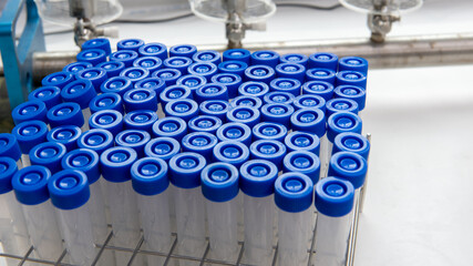 Laboratory filtration system in microbiology laboratory with sample centrifuge tubes