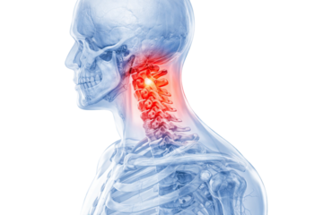 Human cervical spine anatomy showing neck pain inflammation vertebrae injury medical healthcare x-ray illustration isolated on white background