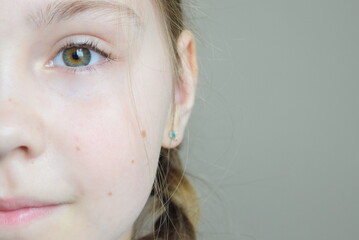 Zielone oko u dzieczynki © Zuzanna