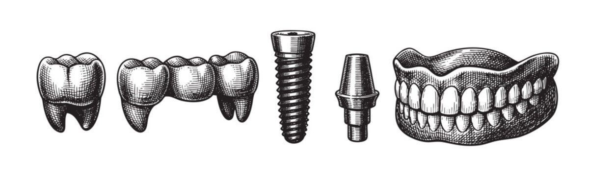 A detailed vintage illustration showcases various dental prosthetics including teeth implants, a bridge, and dentures against a clean white background, representing dental health and restoration.