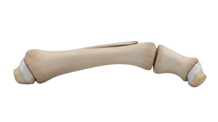 Human toe bones showing a fracture and joint articulation isolated on a transparent background foot break