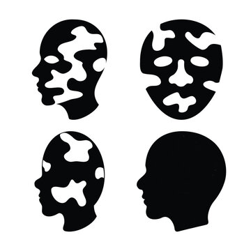 Vitiligo skin condition illustration: exploring skin depigmentation and facial features