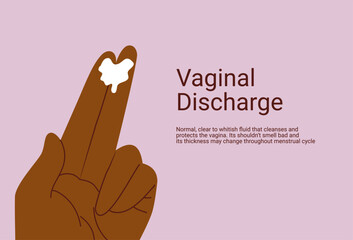 Vaginal discharge symptoms, medical concept of yeast infection, bacterial vaginosis and female reproductive health. Abnormal discharge vector illustration