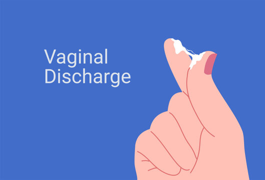Vaginal discharge symptoms, medical concept of yeast infection, bacterial vaginosis and female reproductive health. Abnormal discharge vector illustration