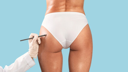 Doctor drawing marks on female buttocks, preparing for cosmetic surgery operation isolated on blue...