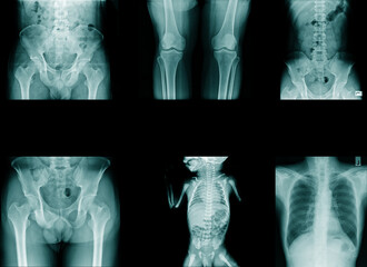 collection xray image in blue tone
