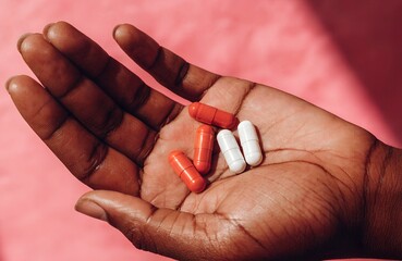 Medication and Health Concept &ndash; Open Hand Holding Red and White Capsules Against Pink Background, pills, capsules, medication, health, pharmaceutical, supplement, hand, red, white, pink, wellness