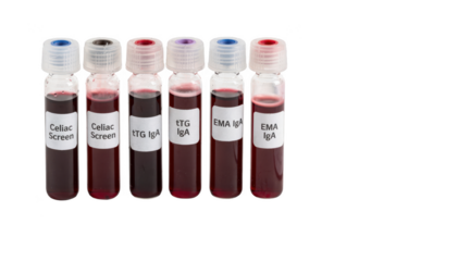 Closeup of blood vials labeled for celiac screening placed neatly beside a blank lab request form on a clean white surface highlighting serologic blood test preparation.