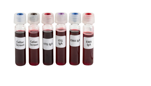 Closeup of blood vials labeled for celiac screening placed neatly beside a blank lab request form on a clean white surface highlighting serologic blood test preparation.