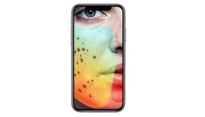 Smartphone displaying AIdriven heatmap overlay analyzing dark spot severity on facial skin isolated on white background highlighting advanced medical imaging technology.