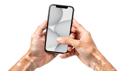 Closeup of depigmented hands gently holding a smartphone against a white background showcasing vitiligo in a modern lifestyle context.