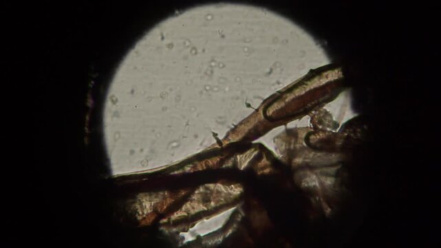 Microscopic image of Aphid bug, extreme close up on microscope of insect in laboratory.