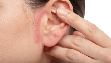 Hand gently touching irritated ear skin displaying subtle redness caused by topical allergy isolated on white background for medical use.