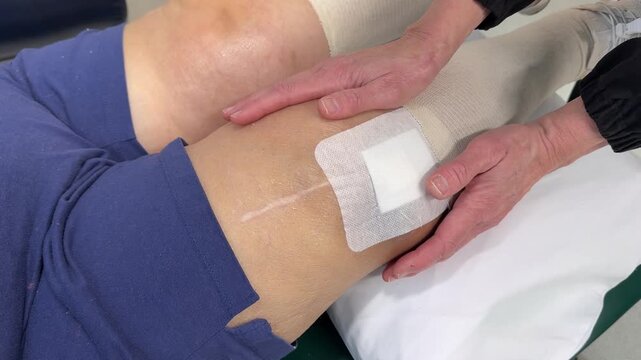 Close-up of a physical therapist treating an elderly patient with lymphedema and knee replacements, applying compression and hands-on care. 15013