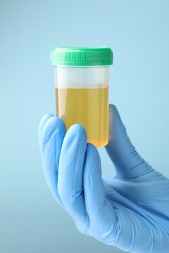 Doctor holding plastic container with urine sample on light blue background, closeup