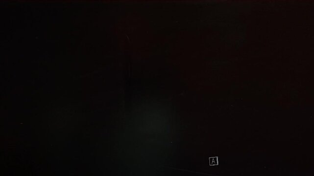 CT Abdomen - movie in coronal plane with internal organs