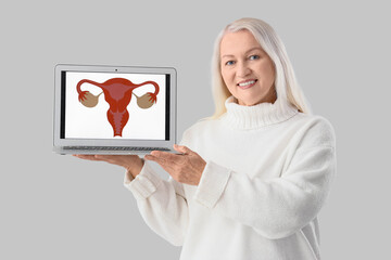 Mature woman holding laptop with uterus image on light background. Menopause concept