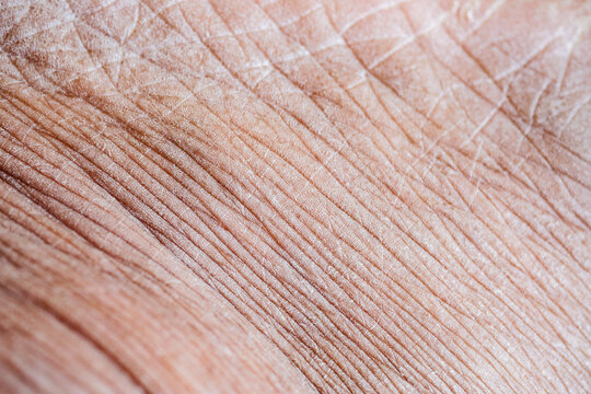 A close up view shows the sry skin of a human hand with lines and wrinkles