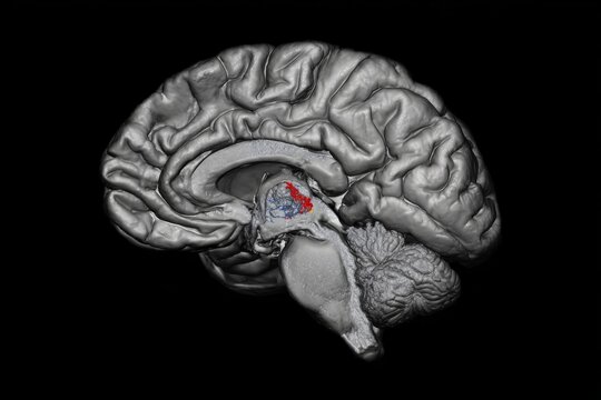 The prefrontal cortex showing reduced activity under stress.