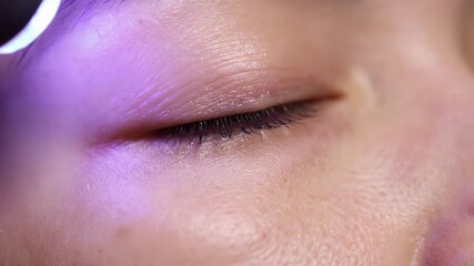 Close Up of Eye Bag Reduction Procedure with Bright Purple Light on White Skin for Cosmetic Surgery Advertising and