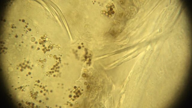 Aeolosoma Worm Digestive System Processing Newly Eaten Algae Cells at 1000X Oil Immersion Microscopic Magnification