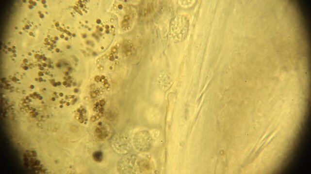 1000X Oil Immersion Microscopic Aeolosoma Worm Digestive System Processing Recently Eaten Algae
