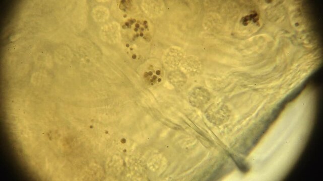 1000X Oil Immersion Microscopic Digestive System of  Fresh Water Aeolosoma Worm Eating Algae 
